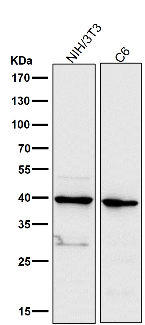 1 - Anti-Cathepsin L/V/K/H Rabbit Monoclonal Antibody ABO14245