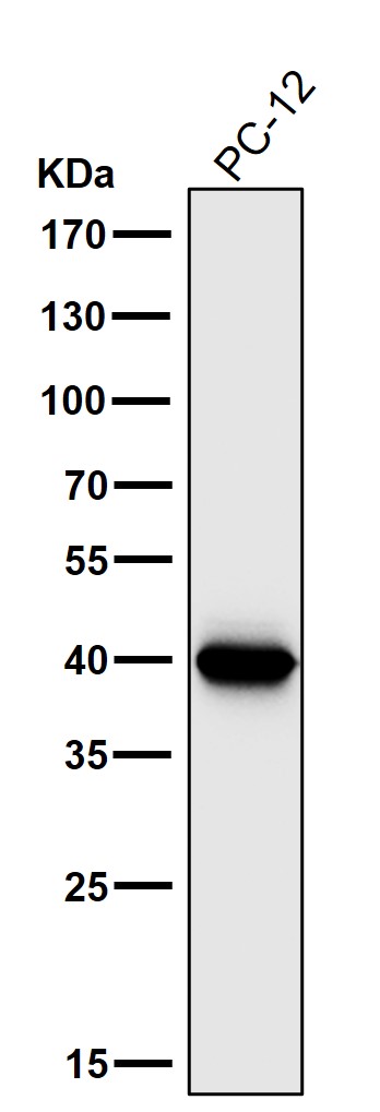 1 - Anti-Cathepsin L/V/K/H Rabbit Monoclonal Antibody ABO14245