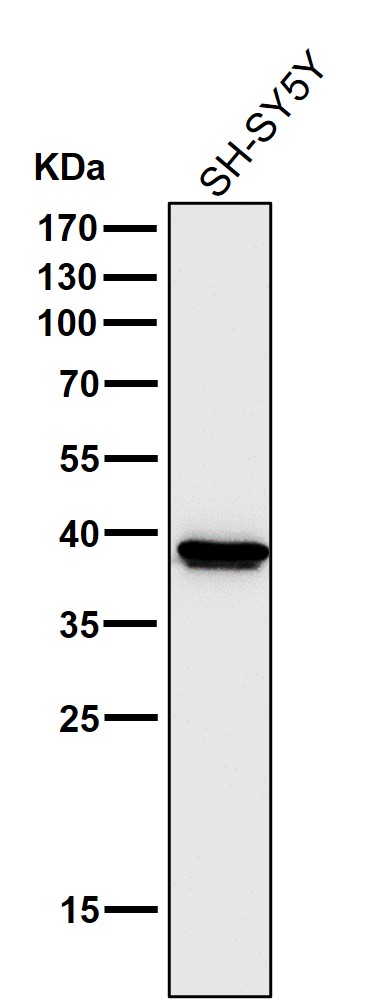 1 - Anti-Cathepsin L/V/K/H Rabbit Monoclonal Antibody ABO14245