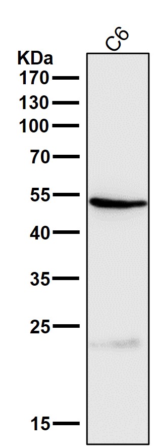 1 - Anti-Cathepsin L/V/K/H Rabbit Monoclonal Antibody ABO14245
