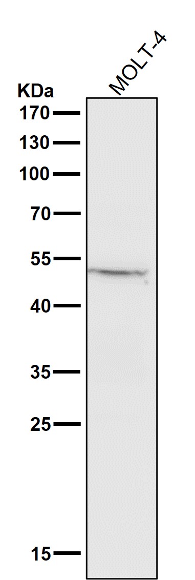1 - Anti-Cathepsin L/V/K/H Rabbit Monoclonal Antibody ABO14245