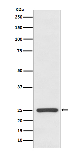 1 - Anti-Kappa light chain IGKC Rabbit Monoclonal Antibody ABO14246