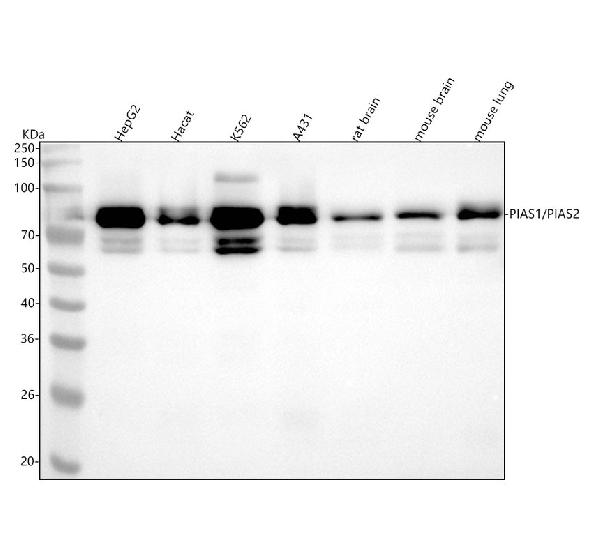 1 - Anti-PIAS1+PIAS2+PIAS3 Rabbit Monoclonal Antibody ABO14247