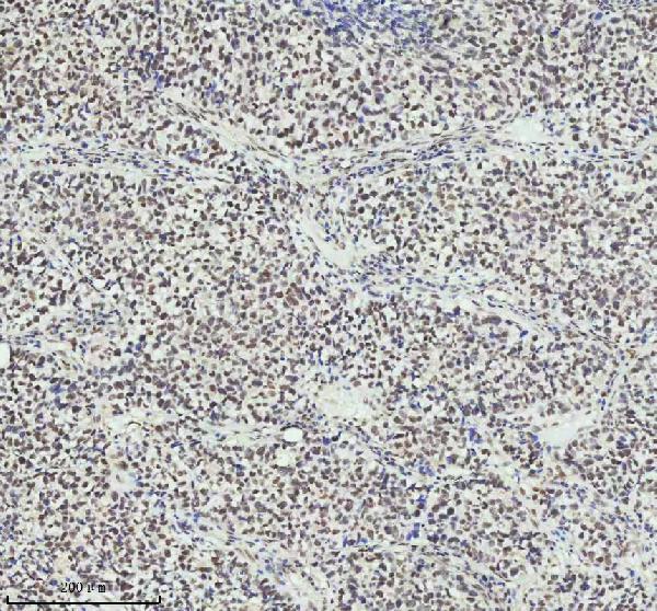 2 - Anti-PIAS1+PIAS2+PIAS3 Rabbit Monoclonal Antibody ABO14247