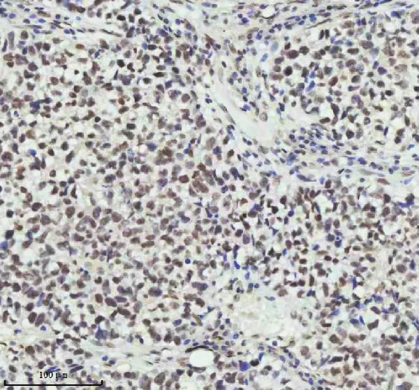 2 - Anti-PIAS1+PIAS2+PIAS3 Rabbit Monoclonal Antibody ABO14247