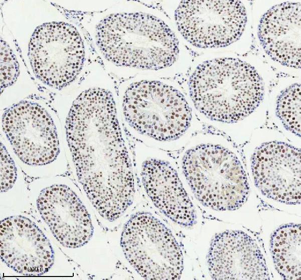 2 - Anti-PIAS1+PIAS2+PIAS3 Rabbit Monoclonal Antibody ABO14247