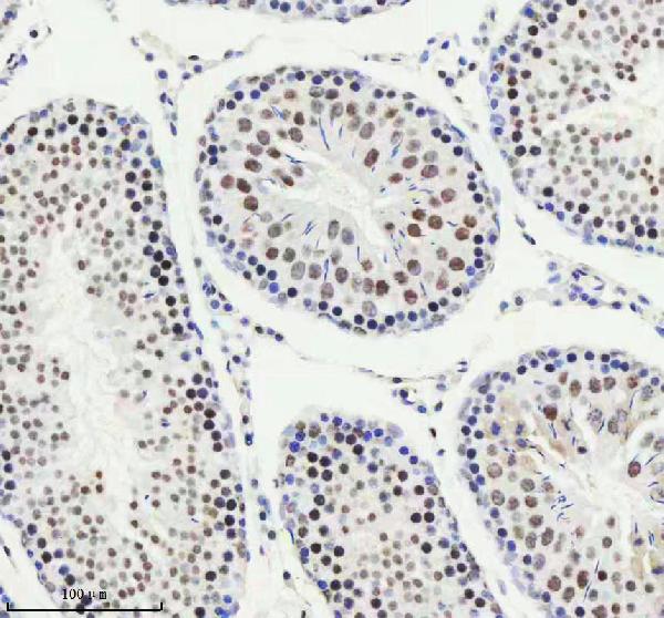 2 - Anti-PIAS1+PIAS2+PIAS3 Rabbit Monoclonal Antibody ABO14247