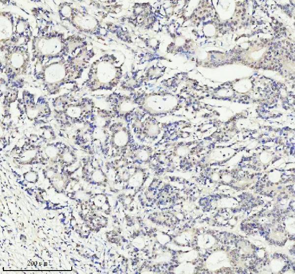 2 - Anti-PIAS1+PIAS2+PIAS3 Rabbit Monoclonal Antibody ABO14247
