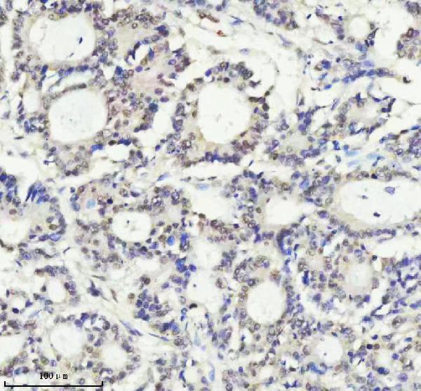 2 - Anti-PIAS1+PIAS2+PIAS3 Rabbit Monoclonal Antibody ABO14247