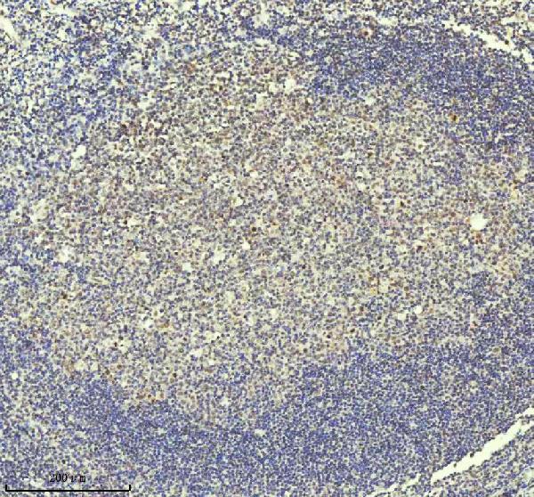2 - Anti-PIAS1+PIAS2+PIAS3 Rabbit Monoclonal Antibody ABO14247