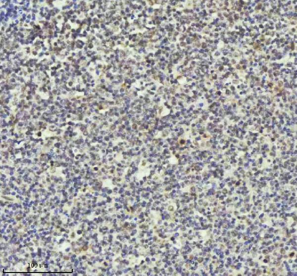 2 - Anti-PIAS1+PIAS2+PIAS3 Rabbit Monoclonal Antibody ABO14247