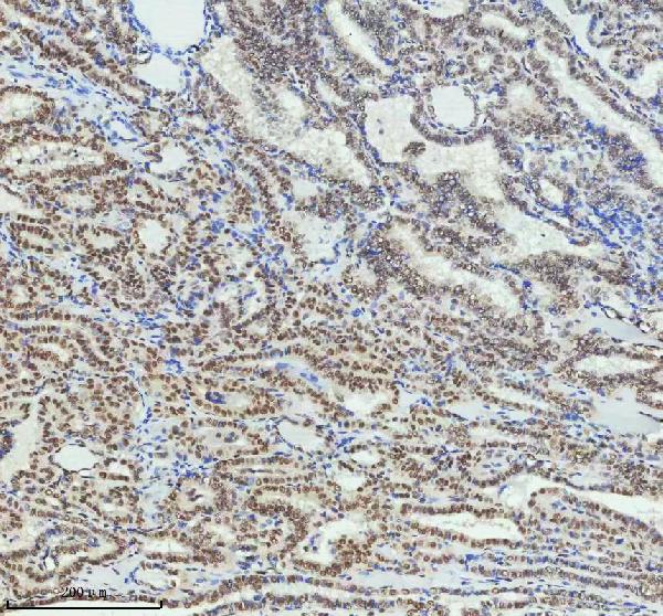 2 - Anti-PIAS1+PIAS2+PIAS3 Rabbit Monoclonal Antibody ABO14247