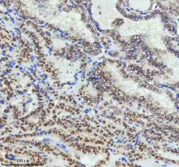 2 - Anti-PIAS1+PIAS2+PIAS3 Rabbit Monoclonal Antibody ABO14247