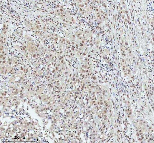 2 - Anti-PIAS1+PIAS2+PIAS3 Rabbit Monoclonal Antibody ABO14247