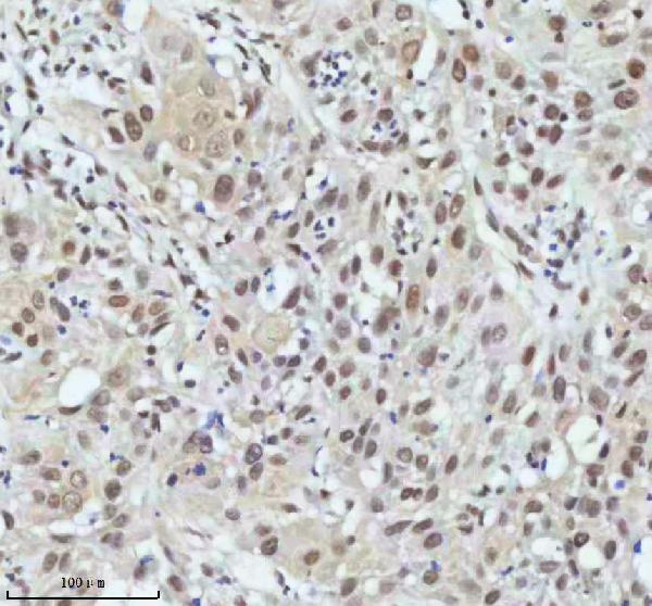 2 - Anti-PIAS1+PIAS2+PIAS3 Rabbit Monoclonal Antibody ABO14247