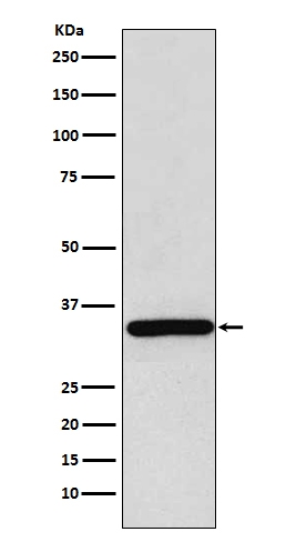 1 - Anti-gamma Sarcoglycan Rabbit Monoclonal Antibody ABO14248