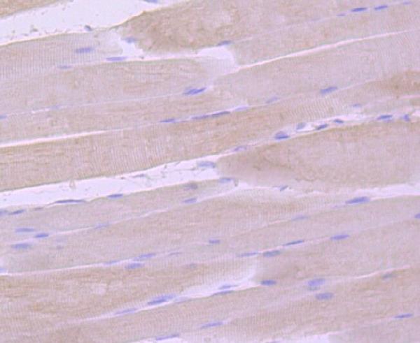 2 - Anti-gamma Sarcoglycan Rabbit Monoclonal Antibody ABO14248