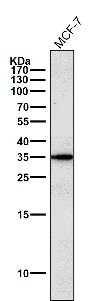 1 - Anti-gamma Sarcoglycan Rabbit Monoclonal Antibody ABO14248