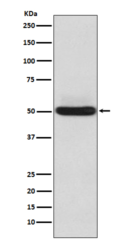 1 - Anti-alpha Sarcoglycan Rabbit Monoclonal Antibody ABO14249