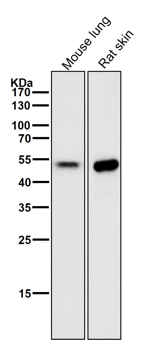 1 - Anti-alpha Sarcoglycan Rabbit Monoclonal Antibody ABO14249
