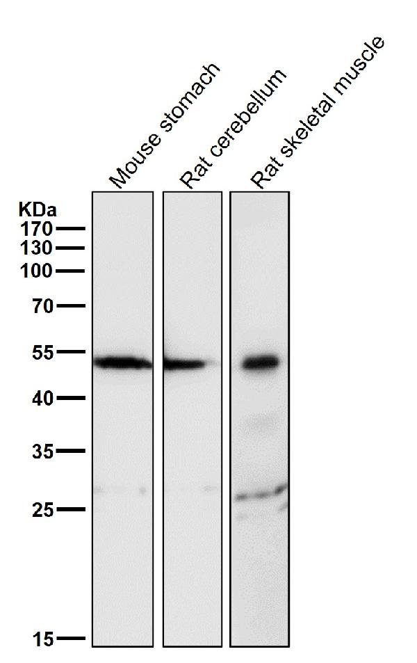 1 - Anti-alpha Sarcoglycan Rabbit Monoclonal Antibody ABO14249