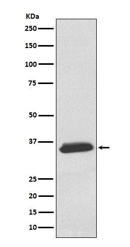 1 - Anti-delta Sarcoglycan SGCD Rabbit Monoclonal Antibody ABO14250