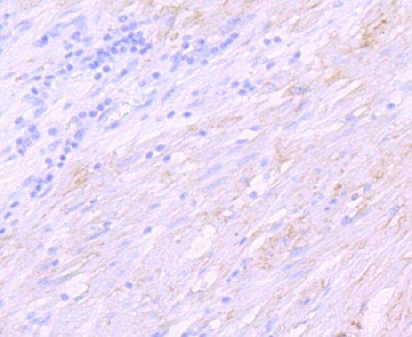 2 - Anti-delta Sarcoglycan SGCD Rabbit Monoclonal Antibody ABO14250