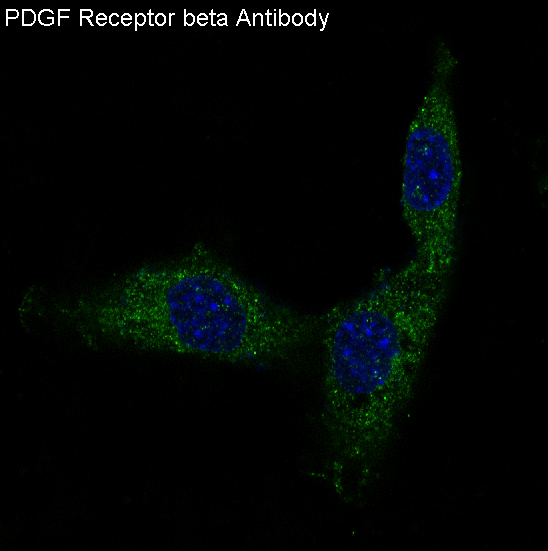 3 - Anti-PDGF Receptor beta PDGFRB Rabbit Monoclonal Antibody ABO14251