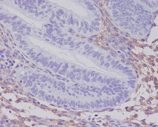 2 - Anti-PDGF Receptor beta PDGFRB Rabbit Monoclonal Antibody ABO14251