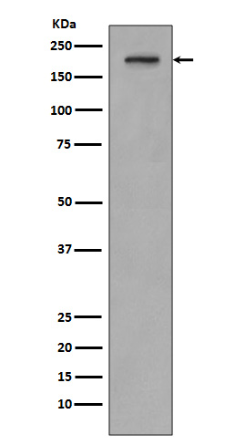 1 - Anti-PDGF Receptor beta PDGFRB Rabbit Monoclonal Antibody ABO14251