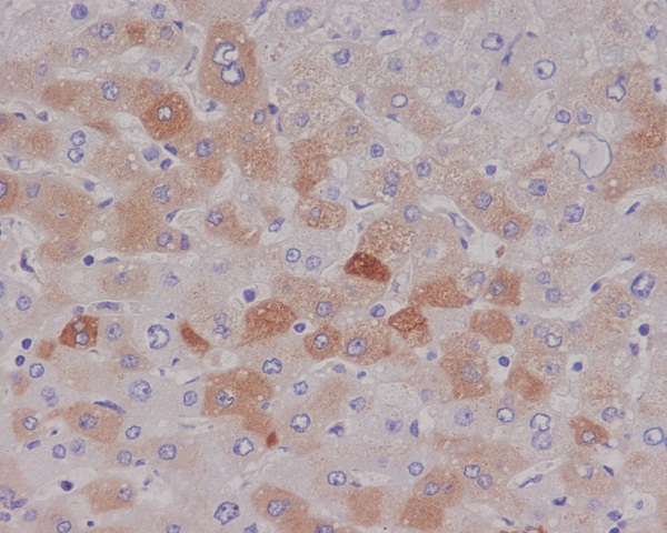2 - Anti-C Reactive Protein CRP Rabbit Monoclonal Antibody ABO14252