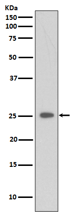 1 - Anti-C Reactive Protein CRP Rabbit Monoclonal Antibody ABO14252
