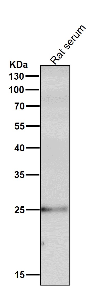 1 - Anti-C Reactive Protein CRP Rabbit Monoclonal Antibody ABO14252