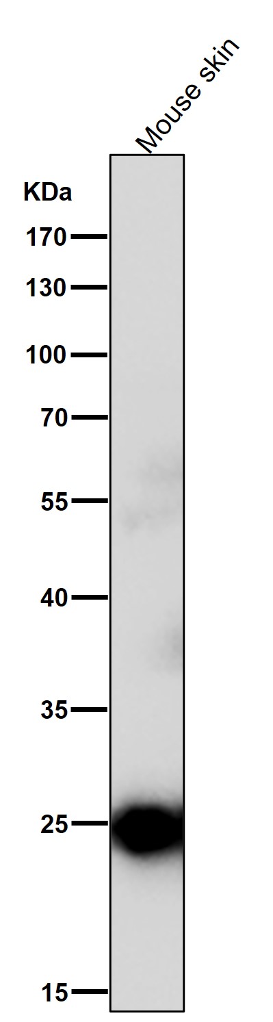 1 - Anti-C Reactive Protein CRP Rabbit Monoclonal Antibody ABO14252