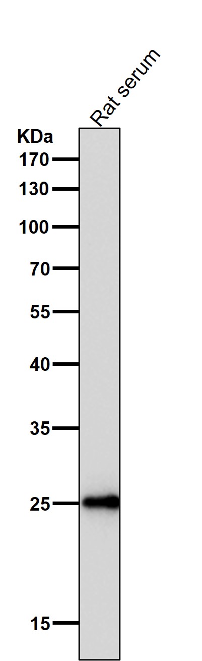 1 - Anti-C Reactive Protein CRP Rabbit Monoclonal Antibody ABO14252