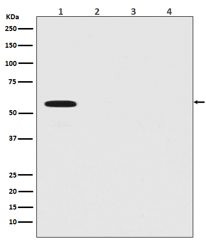 1 - Anti-Firefly Luciferase Rabbit Monoclonal Antibody ABO14254