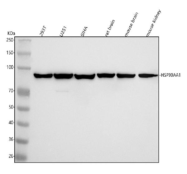 1 - Anti-Hsp90 alpha + beta HSP90AA1 Rabbit Monoclonal Antibody ABO14256