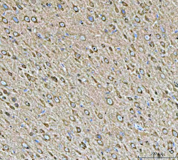 2 - Anti-Hsp90 alpha + beta HSP90AA1 Rabbit Monoclonal Antibody ABO14256