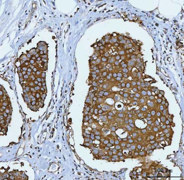 2 - Anti-Hsp90 alpha + beta HSP90AA1 Rabbit Monoclonal Antibody ABO14256