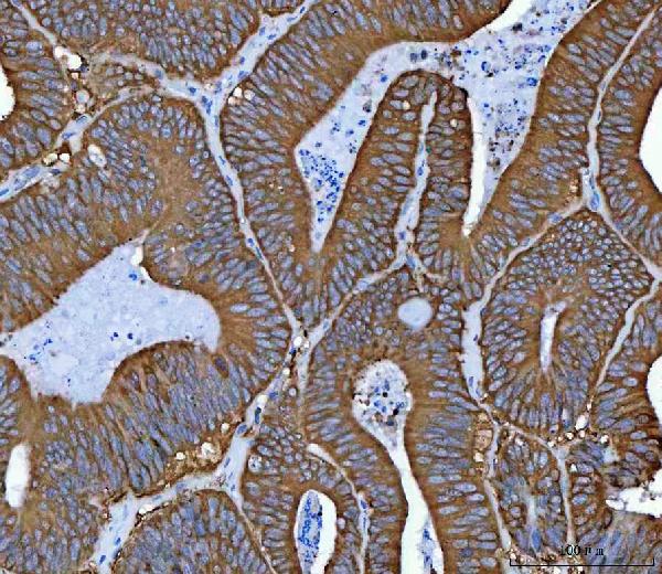 2 - Anti-Hsp90 alpha + beta HSP90AA1 Rabbit Monoclonal Antibody ABO14256