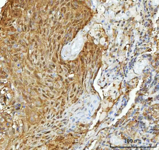 2 - Anti-Hsp90 alpha + beta HSP90AA1 Rabbit Monoclonal Antibody ABO14256