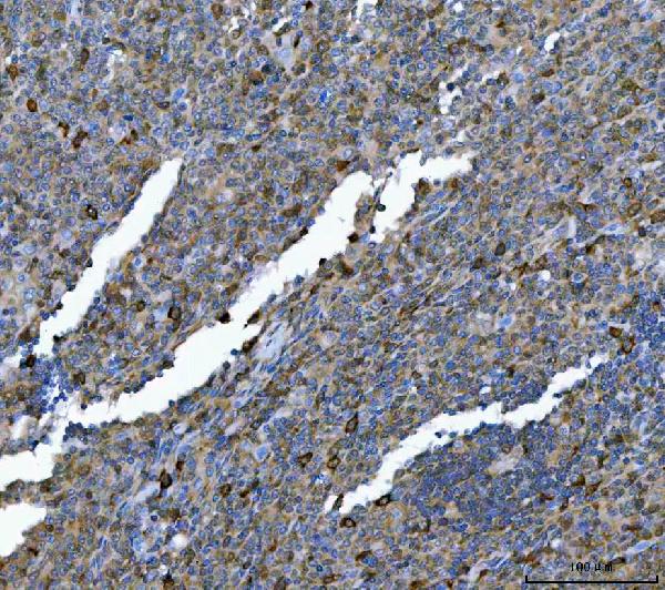 2 - Anti-Hsp90 alpha + beta HSP90AA1 Rabbit Monoclonal Antibody ABO14256