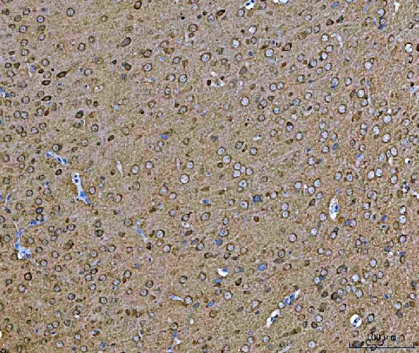 2 - Anti-Hsp90 alpha + beta HSP90AA1 Rabbit Monoclonal Antibody ABO14256