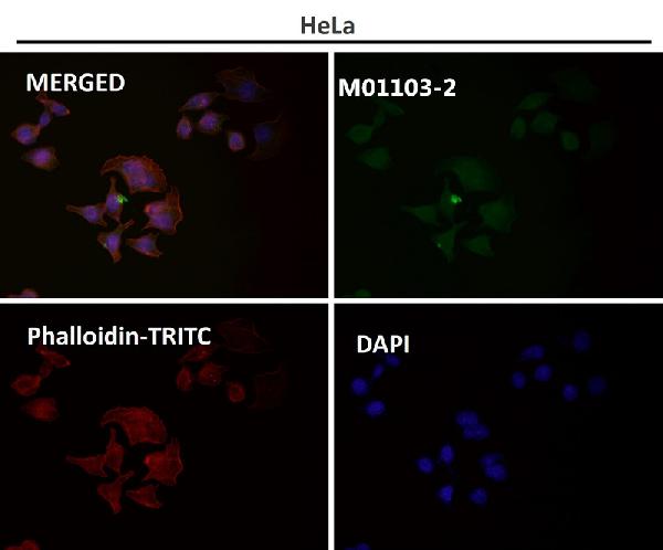 1 - Anti-Hsp90 alpha + beta HSP90AA1 Rabbit Monoclonal Antibody ABO14256