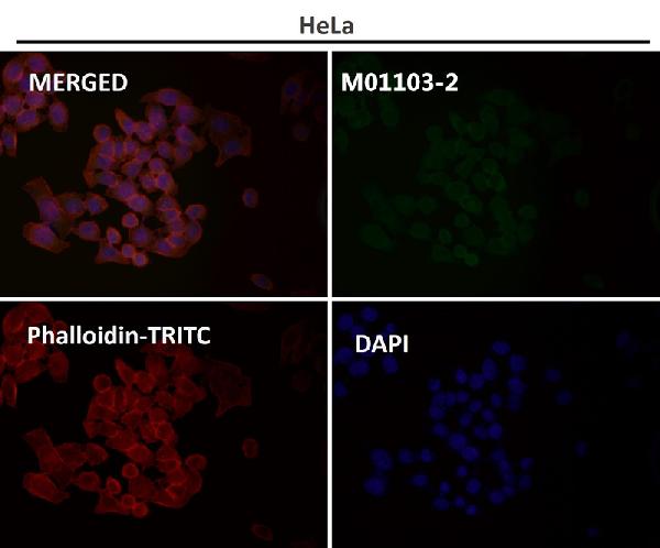 1 - Anti-Hsp90 alpha + beta HSP90AA1 Rabbit Monoclonal Antibody ABO14256
