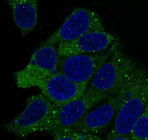 3 - Anti-Hsp90 alpha + beta HSP90AA1 Rabbit Monoclonal Antibody ABO14256