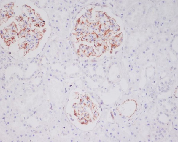 2 - Anti-Mast Cell Tryptase Rabbit Monoclonal Antibody ABO14257