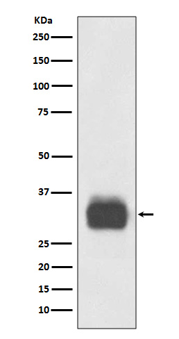 1 - Anti-Mast Cell Tryptase Rabbit Monoclonal Antibody ABO14257