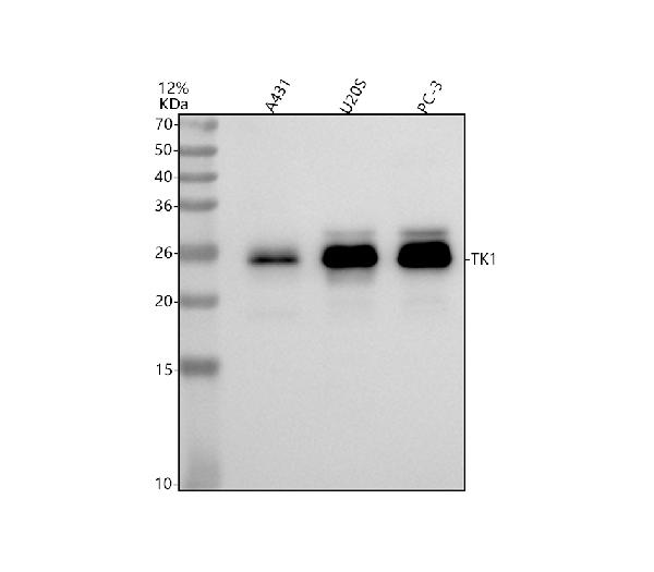 1 - Anti-Thymidine Kinase 1 Rabbit Monoclonal Antibody ABO14258