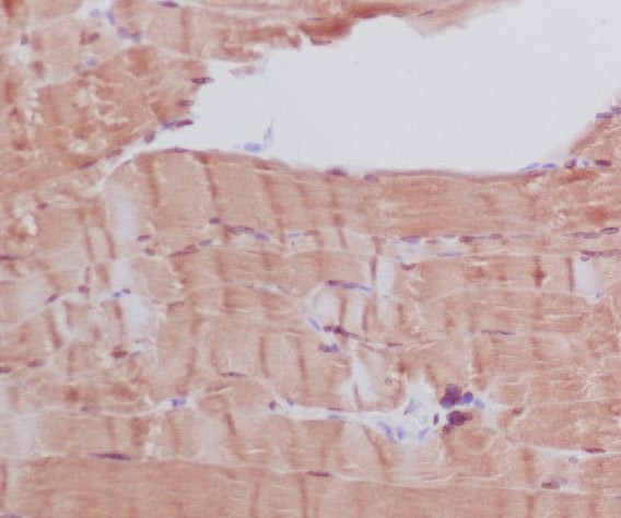 2 - Anti-Myosin heavy chain MYH6 Rabbit Monoclonal Antibody ABO14259